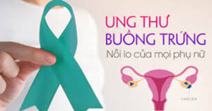 Ung thư buồng trứng